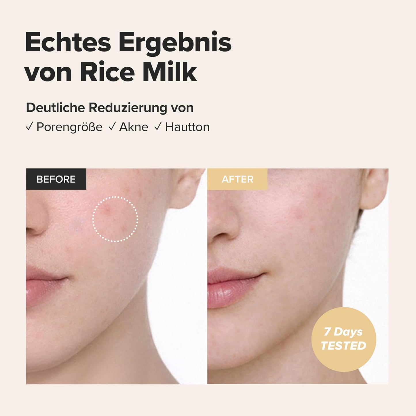 Beauty of Joseon Glow Replenishing Rice Facial Sebum Toner for Oily Combination Skin Korean Moisturizing Balance Care 150 Ml | Skincare Koreanisch