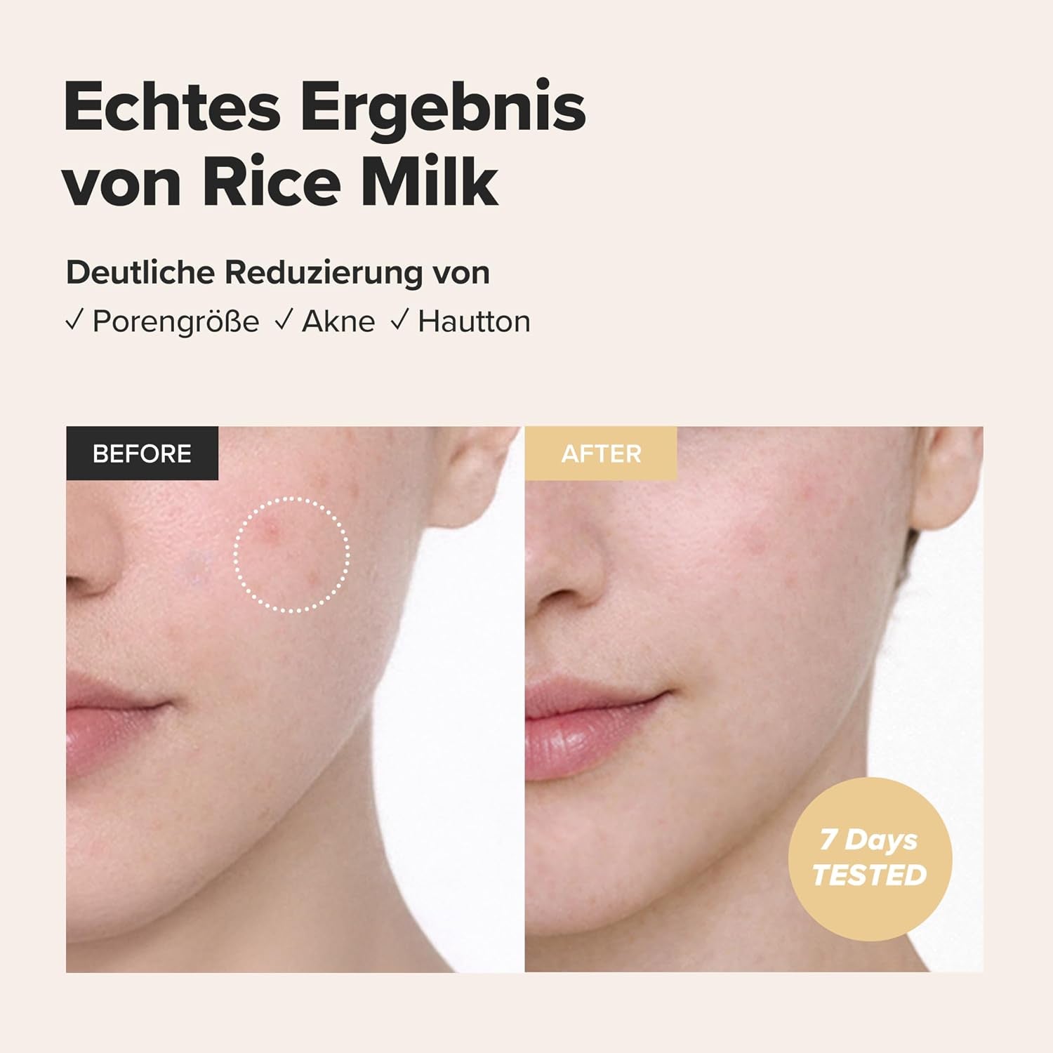Beauty of Joseon Glow Replenishing Rice Facial Sebum Toner for Oily Combination Skin Korean Moisturizing Balance Care 150 Ml | Skincare Koreanisch